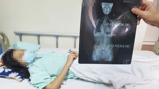 Gia tăng tỷ lệ người trẻ mắc bệnh lý cột sống